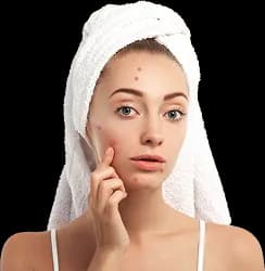 Acne_Test_Package_1.webp